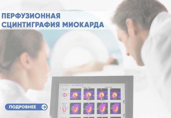 Перфузионная сцинтиграфия миокарда