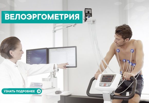 Велоэргометрия