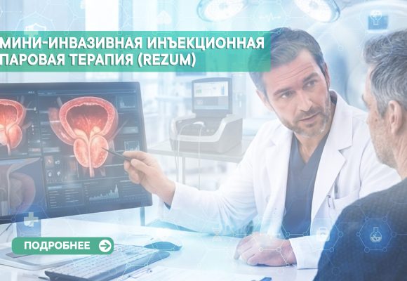 Мини-инвазивная инъекционная паровая терапия (Rezūm) при лечении доброкачественной гиперплазии предстательной железы